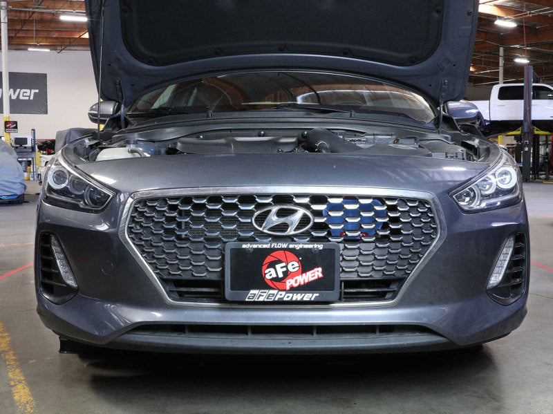 aFe 18-20 Hyundai Elantra GT L4-1.6L (t) Takeda Momentum Dynamic Air Scoop - Blue - Burkken Auto Parts
