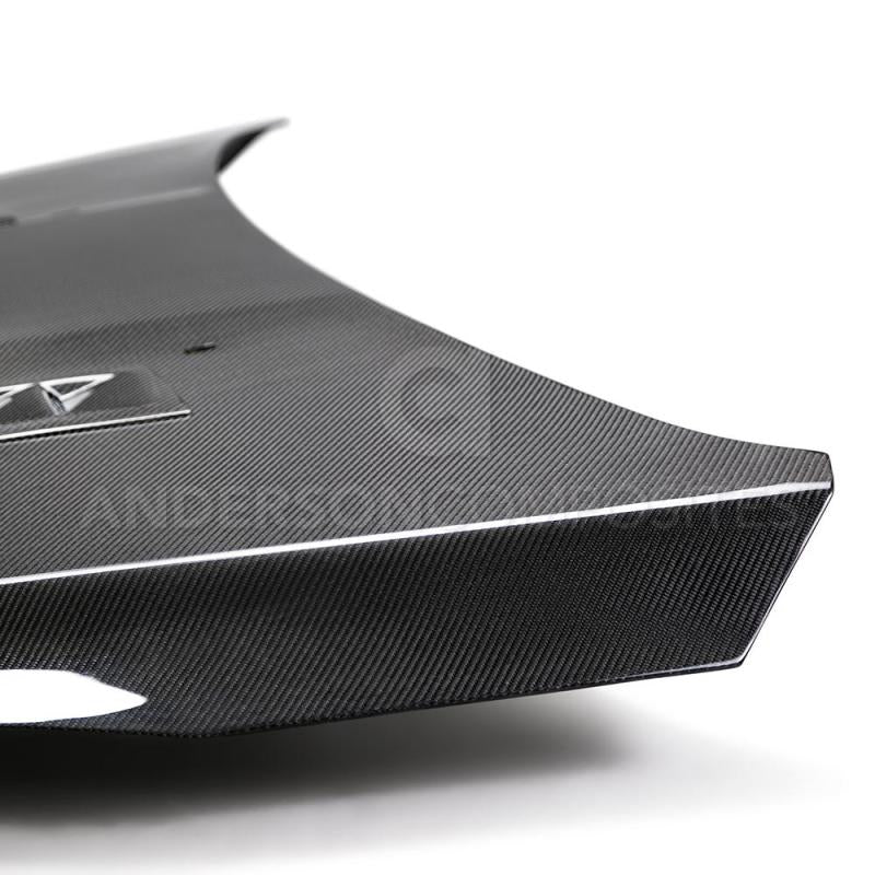 Anderson Composites 2016-2017 Ford Focus ST/RS Carbon Fiber RS Hood - Burkken Auto Parts