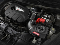 aFe POWER Momentum GT Pro Dry S Intake System 14-15 Ford Fiesta ST L4-1.6L (t) - Burkken Auto Parts