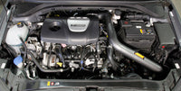 AEM 2017 C.A.S Hyundai Elantra L4-1.6L F/I Cold Air Intake - Burkken Auto Parts