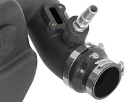 Momentum GT Pro DRY S Stage-2 Intake System 13-16 Cadillac ATS L4-2.0L (t) - Burkken Auto Parts