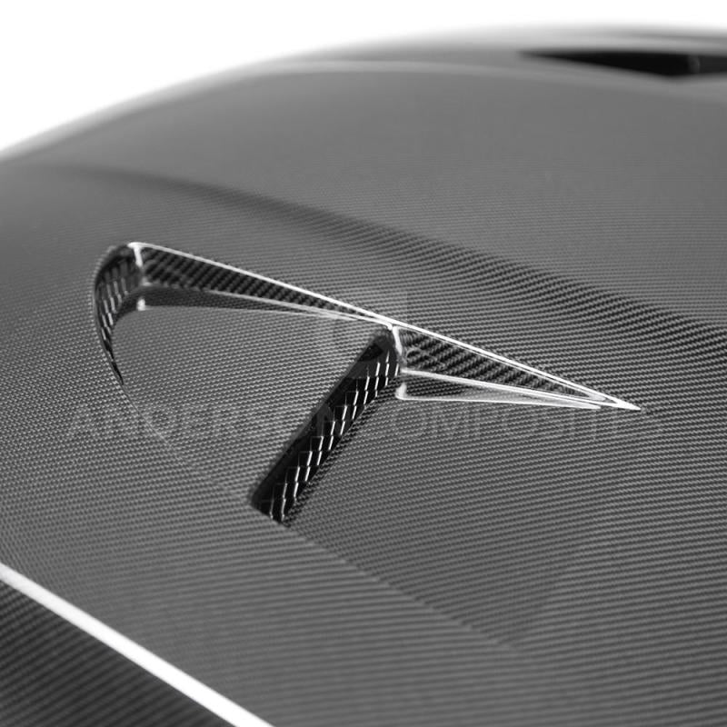 Anderson Composites 2015+ Ford Focus RS Type-SA Carbon Fiber Hood - Burkken Auto Parts